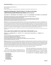 Эндопротезирование голеностопного сустава в сочетании с дополнительными вмешательствами (обзор литературы)