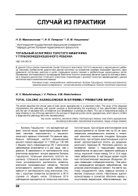 Тотальный аганглиоз толстого кишечника у глубоко недоношенного ребенка