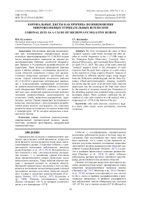 Корональные джеты как причина возникновения микроволновых отрицательных всплесков