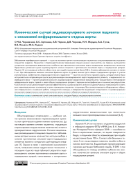 Клинический случай эндоваскулярного лечения пациента с окклюзией инфраренального отдела аорты