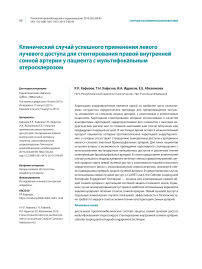 Клинический случай успешного применения левого лучевого доступа для стентирования правой внутренней сонной артерии у пациента с мультифокальным атеросклерозом