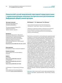 Клинический случай эверсионной каротидной эндартерэктомии с нервосохраняющим компонентом при высоком расположении бифуркации общей сонной артерии