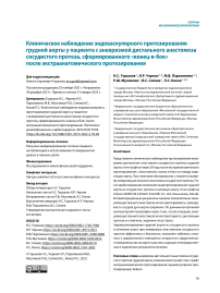 Клиническое наблюдение эндоваскулярного протезирования грудной аорты у пациента с аневризмой дистального анастомоза сосудистого протеза, сформированного «конец-в-бок» после экстраанатомического протезирования