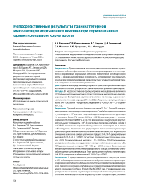 Непосредственные результаты транскатетерной имплантации аортального клапана при горизонтально ориентированном корне аорты