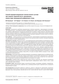 Способ эндопротезирования голеностопного сустава при некрозе таранной кости, крузартрозе, эквино-варо-приведенной деформации стопы