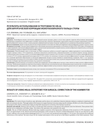 Результаты использования остеотомии по helal для хирургической коррекции молоткообразного пальца стопы