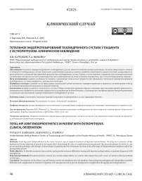 Тотальное эндопротезирование тазобедренного сустава у пациента с остеопетрозом. Клиническое наблюдение