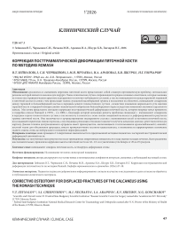Коррекция посттравматической деформации пяточной кости по методике Romash