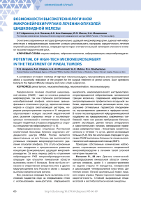 Возможности высокотехнологичной микронейрохирургии в лечении опухолей шишковидной железы