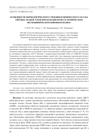 Особенности морфологического строения и химического состава твёрдых тканей зубов при болезни Крона и хроническом неспецифическом язвенном колите