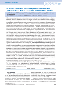 Морфологическая и молекулярно-генетическая диагностика Cadasil: редкий клинический случай