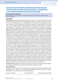 Клинические примеры правильной ориентации торической интраокулярной линзы у пациентов с посткератотомической кератэктазией