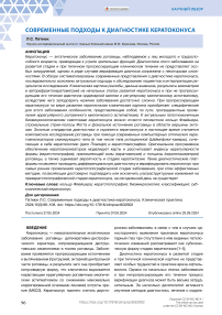 Современные подходы к диагностике кератоконуса