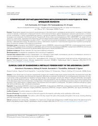 Клинический случай диагностики металлического инородного тела брюшной полости