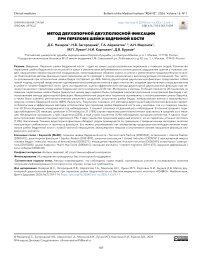 Метод двухопорной двухполюсной фиксации при переломе шейки бедренной кости