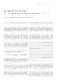 Инфаркт миокарда, осложненный кардиогенным шоком