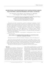 Необратимая электропорация метастазов колоректального рака в печень с использованием системы "Nanoknife"