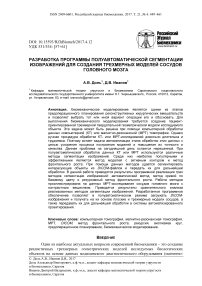 Разработка программы полуавтоматической сегментации изображений для создания трехмерных моделей сосудов головного мозга