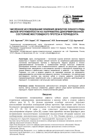 Численное исследование влияния дефектов зубного ряда малой протяженности на напряженно-деформированное состояние мостовидного протеза и периодонта