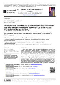 Исследование напряженно-деформированного состояния зубного иммедиат-протеза и сопряженных с ним тканей под действием внешней силы