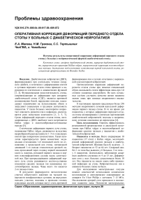 Оперативная коррекция деформаций переднего отдела стопы у больных с диабетической нейропатией