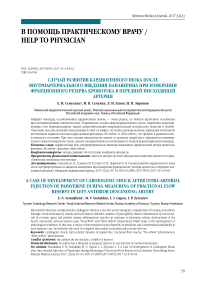 Случай развития кардиогенного шока после внутриартериального введения папаверина при измерении фракционного резерва кровотока в передней нисходящей артерии