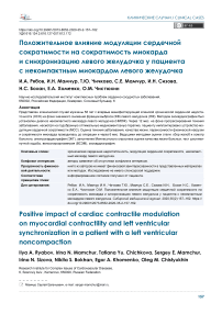 Положительное влияние модуляции сердечной сократимости на сократимость миокарда и синхронизацию левого желудочка у пациента с некомпактным миокардом левого желудочка