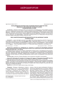 Кольцевидное контрастное усиление при МР-диагностике объемных образований головного мозга (клинический случай)