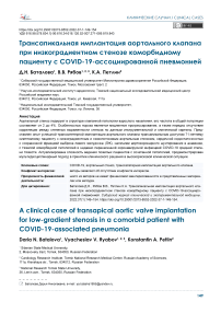 Трансапикальная имплантация аортального клапана при низкоградиентном стенозе коморбидному пациенту с COVID-19-ассоциированной пневмонией