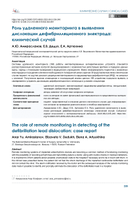 Роль удаленного мониторинга в выявлении дислокации дефибрилляционного электрода: клинический случай