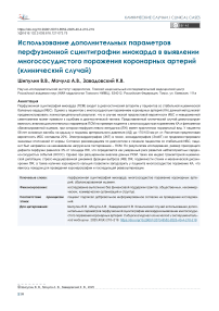 Использование дополнительных параметров перфузионной сцинтиграфии миокарда в выявлении многососудистого поражения коронарных артерий (клинический случай)
