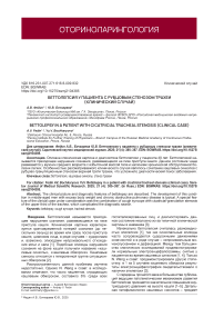 Беттолепсия у пациента с рубцовым стенозом трахеи (клинический случай)