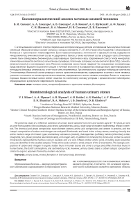 Биоминералогический анализ мочевых камней человека