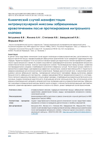Клинический случай манифестации интрамускулярной миксомы забрюшинным кровотечением после протезирования митрального клапана