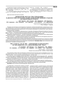 Применение метода ТРФ-топографии в диагностике воспалительных изменений нижних отделов респираторного тракта