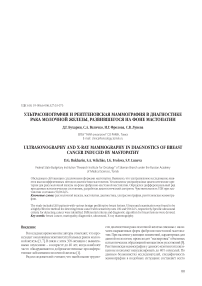 Ультрасонография и рентгеновская маммография в диагностике рака молочной железы, развившегося на фоне мастопатии