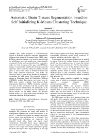 Automatic brain tissues segmentation based on self initializing K-Means clustering technique