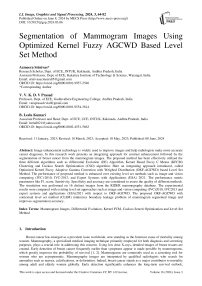 Segmentation of Mammogram Images Using Optimized Kernel Fuzzy AGCWD Based Level Set Method