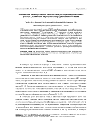 Особенности радионуклидной диагностики рака щитовидной железы: факторы, влияющие на результаты радиоизотопного теста