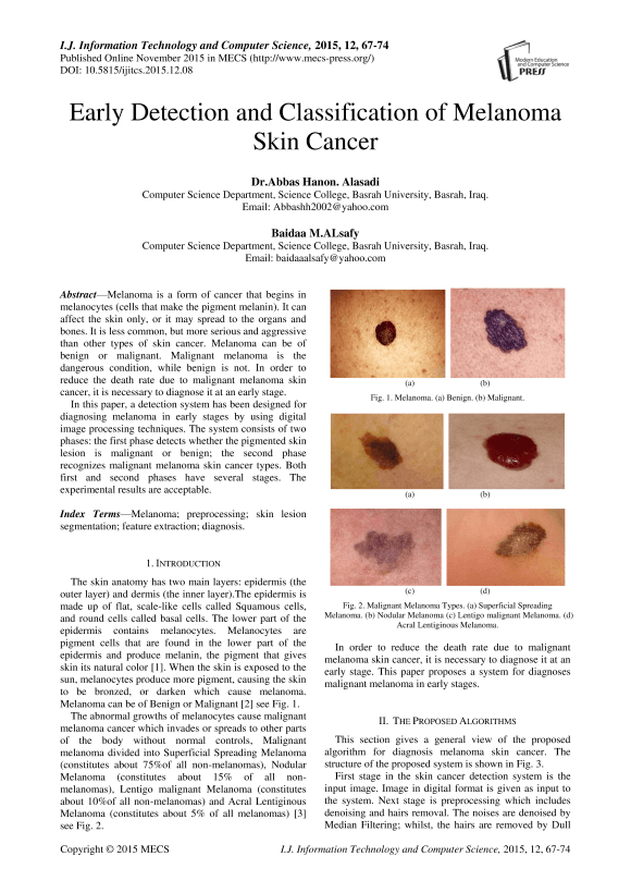 Early Detection And Classification Of Melanoma Skin Cancer Ijitcs