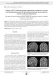 "Немая" АКТГ-секретирующая карцинома гипофиза с экстра- и интракраниальными метастазами (описание клинического случая и обзор литературы)
