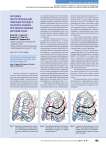 Методика экстраторакальной фиксации переднего реберного клапана при множественном переломе ребер