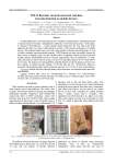 Yolo-barcode: towards universal real-time barcode detection on mobile devices