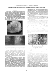 Компьютерная система анализа диагностических кристаллограм