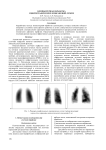 Компьютерная обработка сцинтиграфических изображений легких