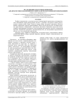 Исследование текстурных признаков для диагностики заболеваний костной ткани по рентгеновским изображениям
