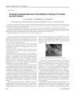 Лечение инфицированных переломов и ложных суставов костей голени