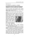 Обеспечение сохранности элементов колесных пар подвижного состава при башмачном торможении
