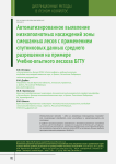 Автоматизированное выявление низкополнотных насаждений зоны смешанных лесов с применением спутниковых данных среднего разрешения на примере учебно-опытного лесхоза БГТУ