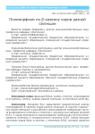 Полиморфизм по β-казеину коров разной селекции